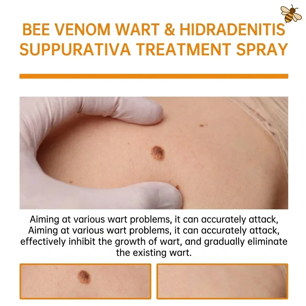 BeeVenom Mole/Tag Remover - Image 2